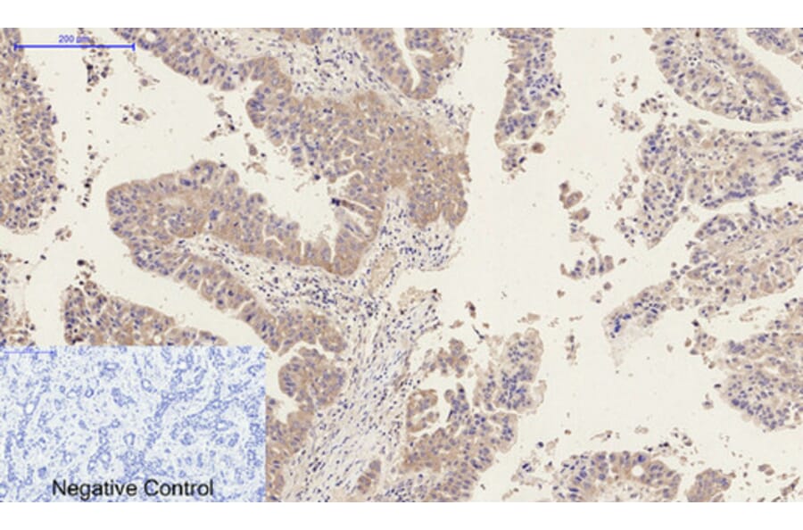 Immunohistochemistry - Anti-MMP9 Antibody (C30044) - Antibodies.com