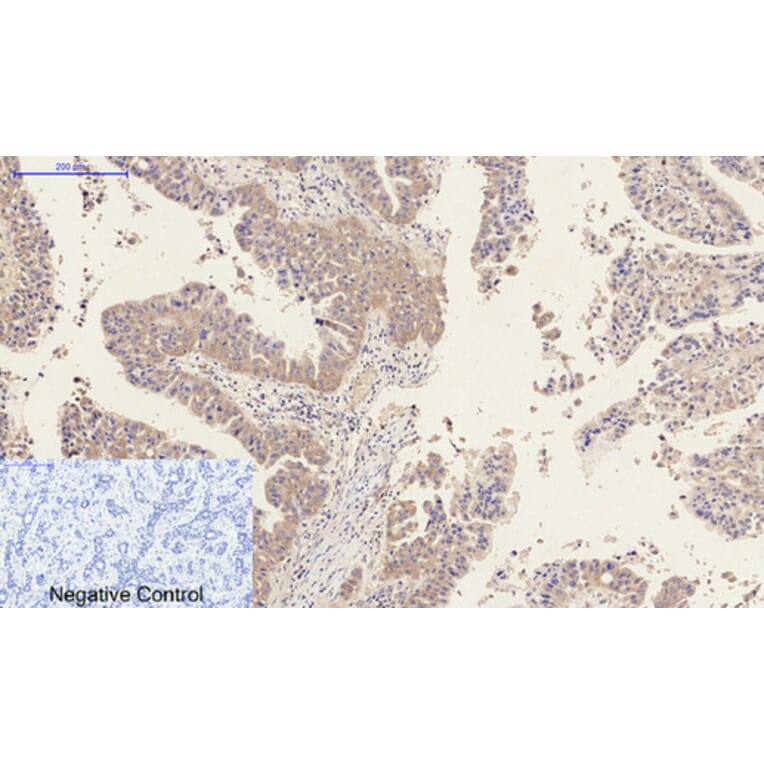 Immunohistochemistry - Anti-MMP9 Antibody (C30044) - Antibodies.com