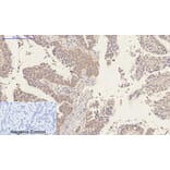 Immunohistochemistry - Anti-MMP9 Antibody (C30044) - Antibodies.com