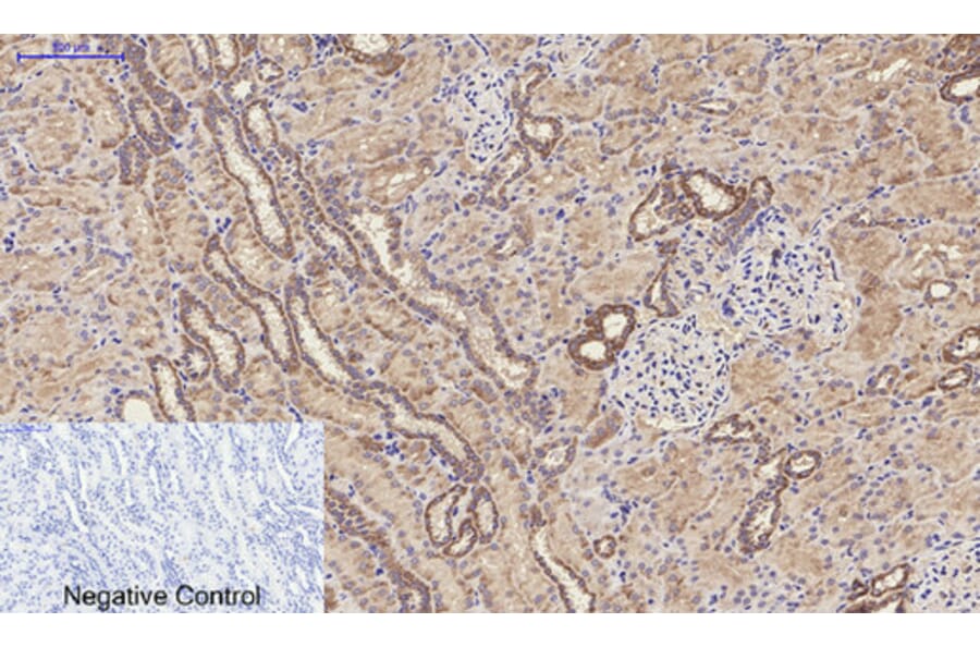 Immunohistochemistry - Anti-MMP9 Antibody (C30044) - Antibodies.com