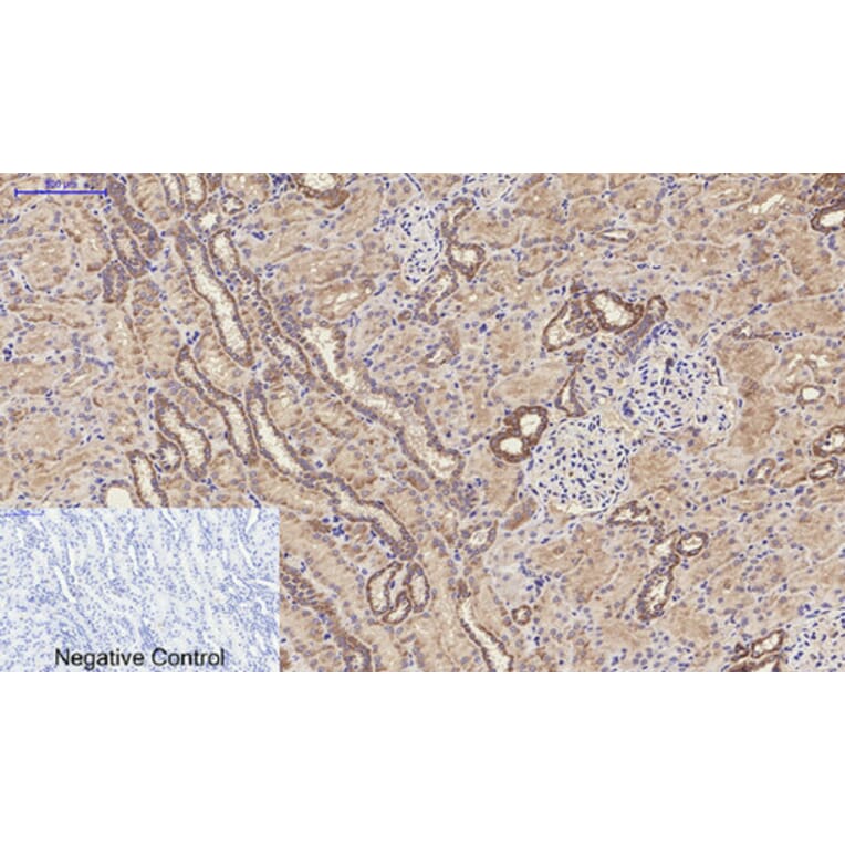 Immunohistochemistry - Anti-MMP9 Antibody (C30044) - Antibodies.com