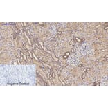 Immunohistochemistry - Anti-MMP9 Antibody (C30044) - Antibodies.com