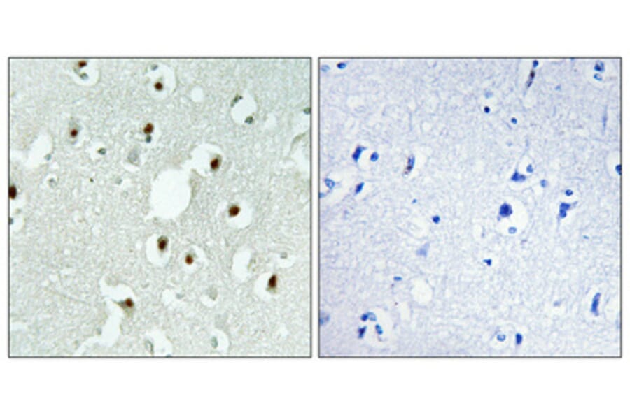 Immunohistochemistry - Anti-MLH3 Antibody (C13087) - Antibodies.com