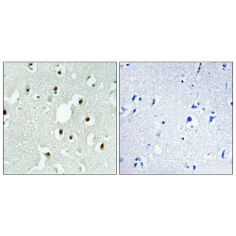 Immunohistochemistry - Anti-MLH3 Antibody (C13087) - Antibodies.com