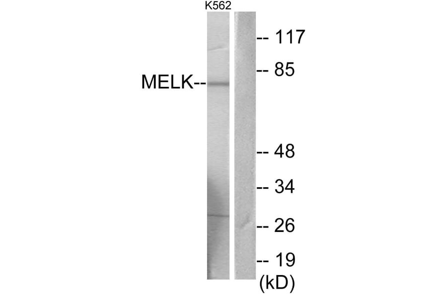 Western Blot - Anti-MELK Antibody (C11043) - Antibodies.com
