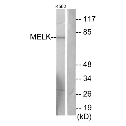 Western Blot - Anti-MELK Antibody (C11043) - Antibodies.com