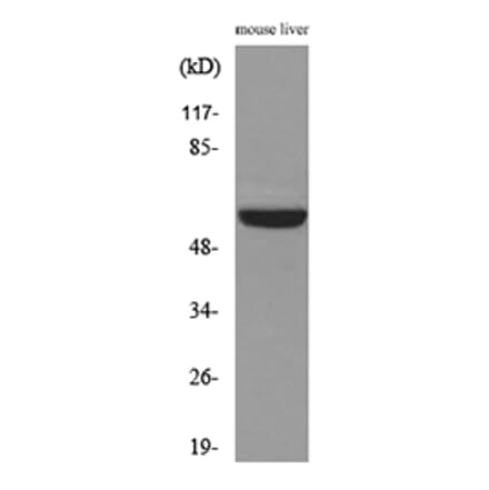 Western Blot - Anti-MDM2 Antibody (C30111) - Antibodies.com
