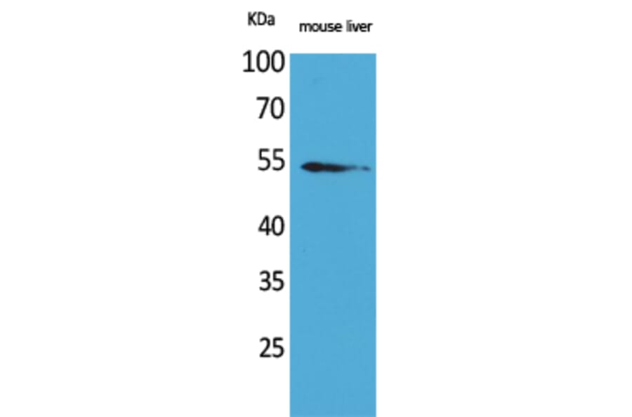 Western Blot - Anti-MDM2 Antibody (C30111) - Antibodies.com