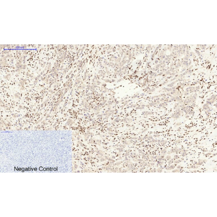 Immunohistochemistry - Anti-MDM2 Antibody (C30111) - Antibodies.com