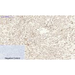 Immunohistochemistry - Anti-MDM2 Antibody (C30111) - Antibodies.com