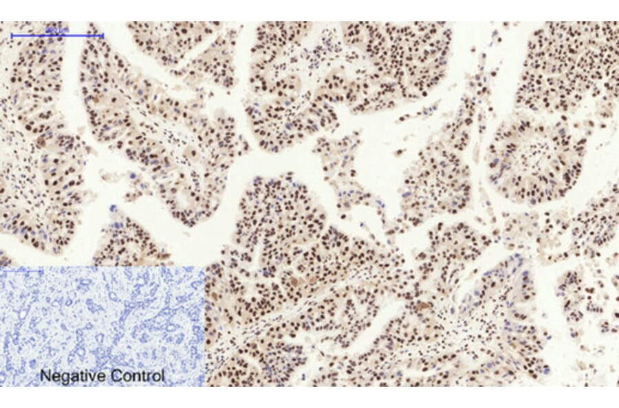 Immunohistochemistry - Anti-MDM2 Antibody (C30111) - Antibodies.com