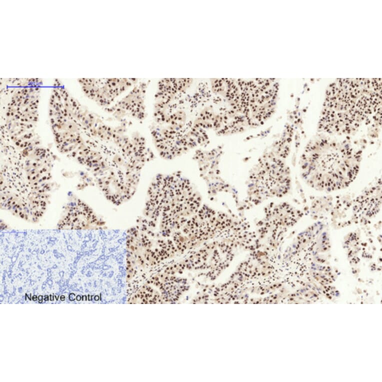 Immunohistochemistry - Anti-MDM2 Antibody (C30111) - Antibodies.com