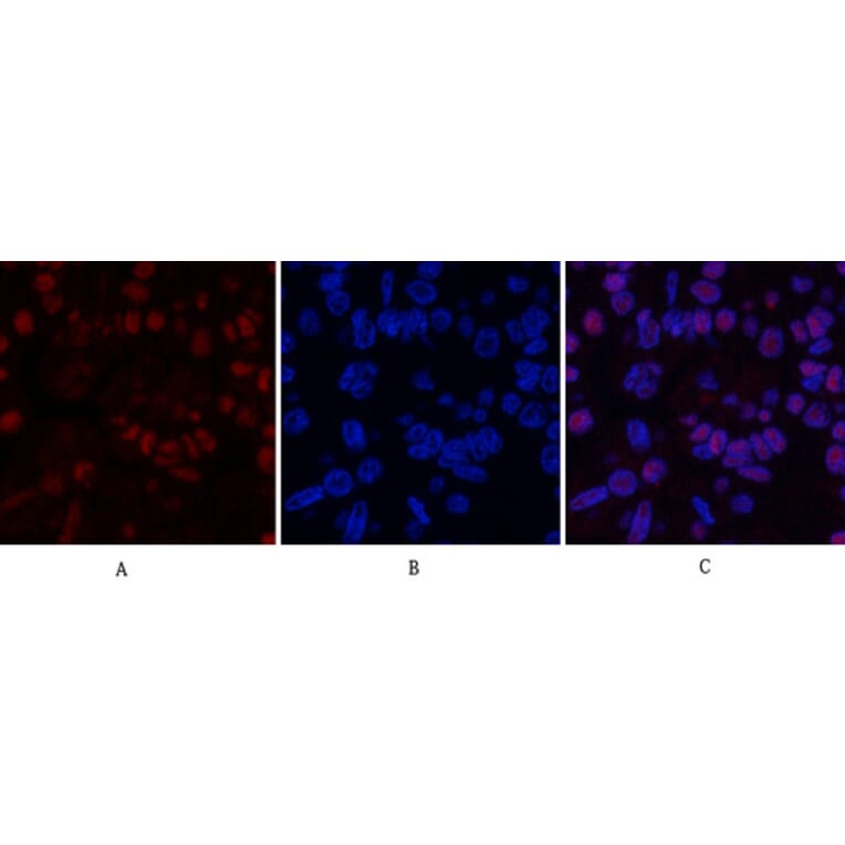 Immunofluorescence - Anti-MDM2 Antibody (C30111) - Antibodies.com