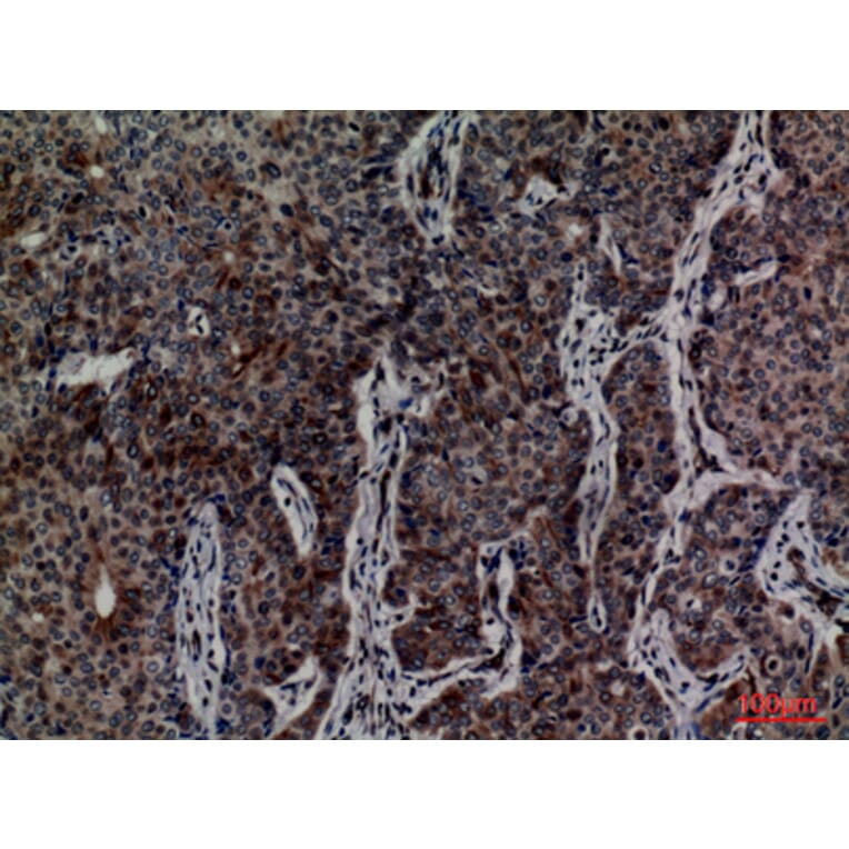 Immunohistochemistry - Anti-MCM3 Antibody (C30244) - Antibodies.com