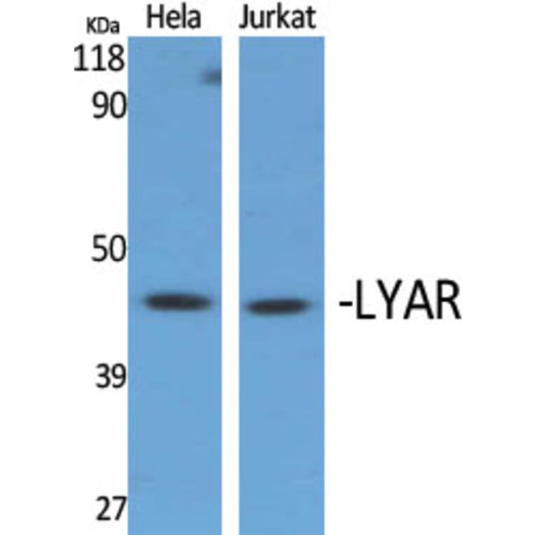 Western Blot - Anti-LYAR Antibody (C15030) - Antibodies.com