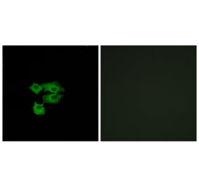 Immunofluorescence - Anti-LY6E Antibody (C16522) - Antibodies.com