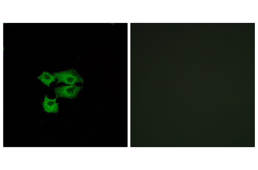 Immunofluorescence - Anti-LY6E Antibody (C16522) - Antibodies.com