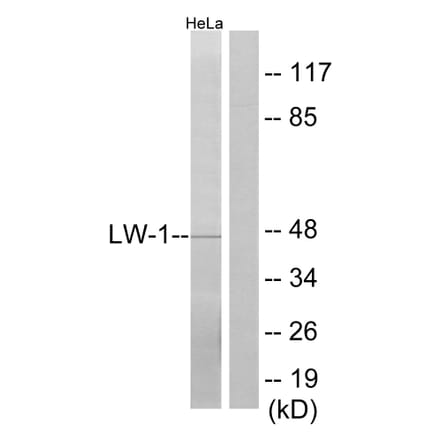 Western Blot - Anti-LW-1 Antibody (C11810) - Antibodies.com
