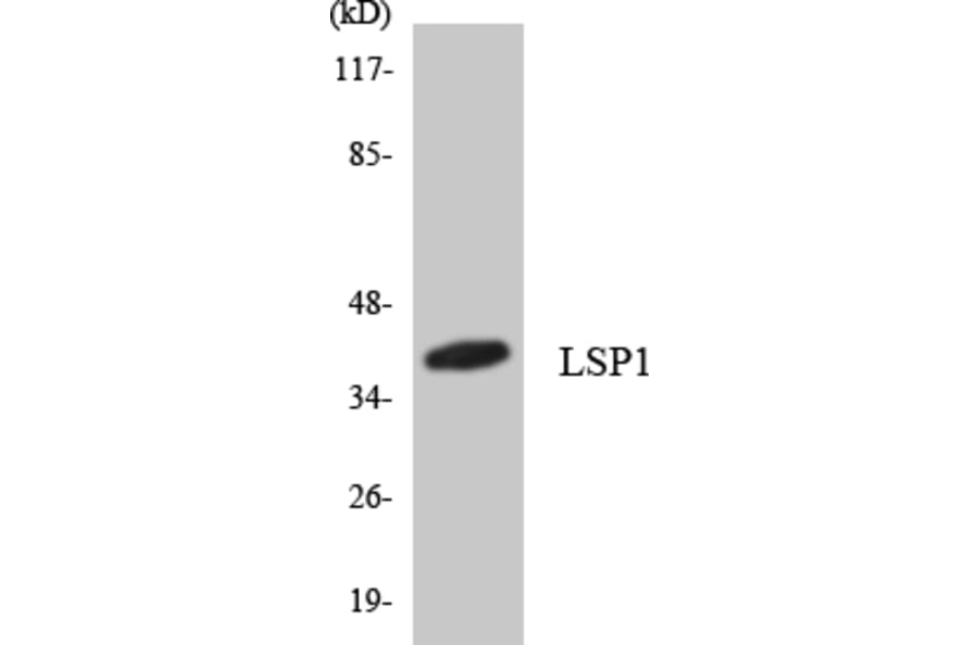 Western Blot - Anti-LSP1 Antibody (R12-2978) - Antibodies.com