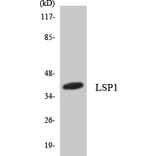 Western Blot - Anti-LSP1 Antibody (R12-2978) - Antibodies.com
