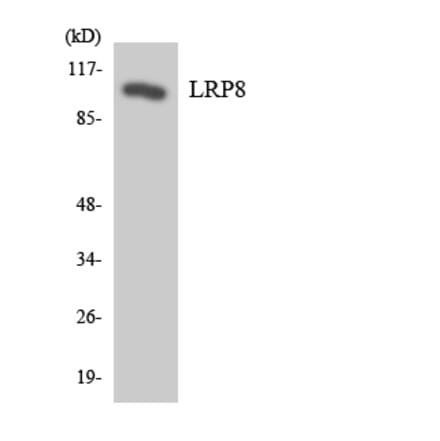 Western Blot - Anti-LRP8 Antibody (R12-2977) - Antibodies.com