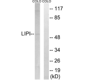 Western Blot - Anti-LIPI Antibody (C16481) - Antibodies.com