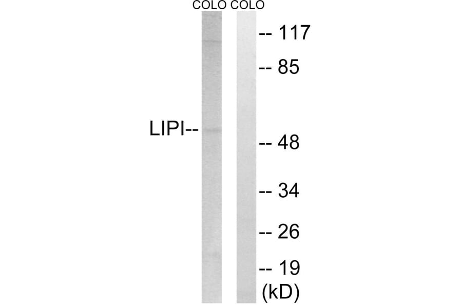 Western Blot - Anti-LIPI Antibody (C16481) - Antibodies.com