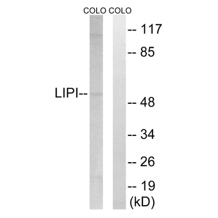 Western Blot - Anti-LIPI Antibody (C16481) - Antibodies.com