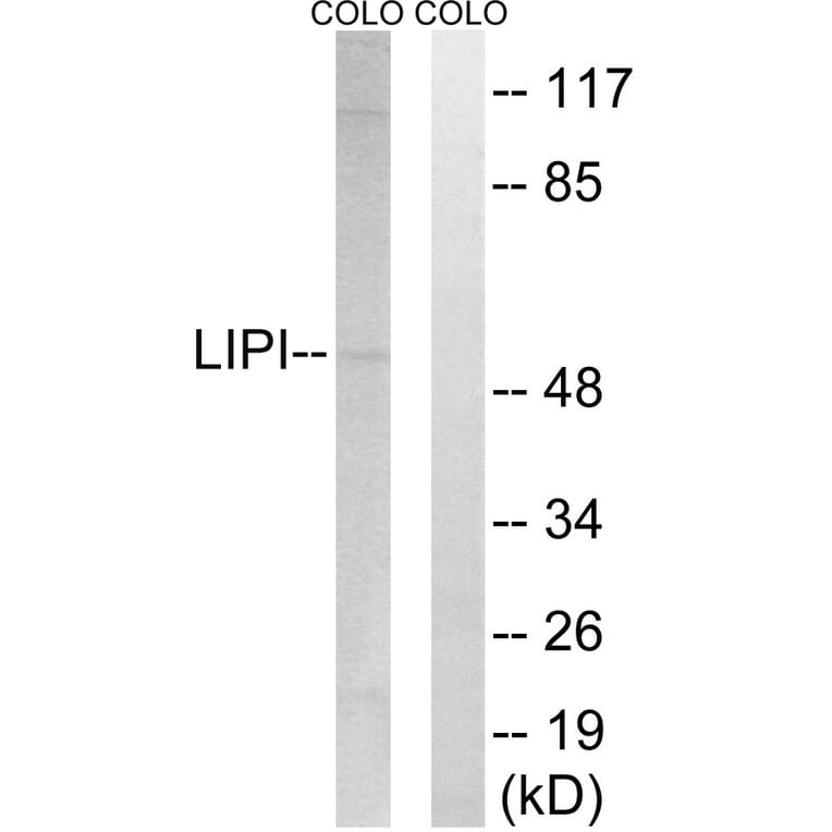 Western Blot - Anti-LIPI Antibody (C16481) - Antibodies.com