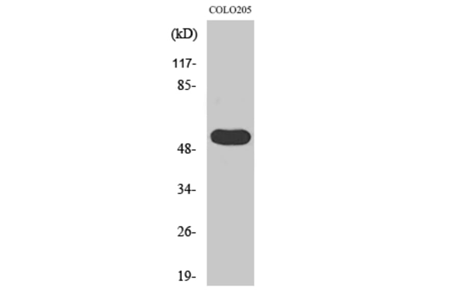 Western Blot - Anti-LIPI Antibody (C16481) - Antibodies.com