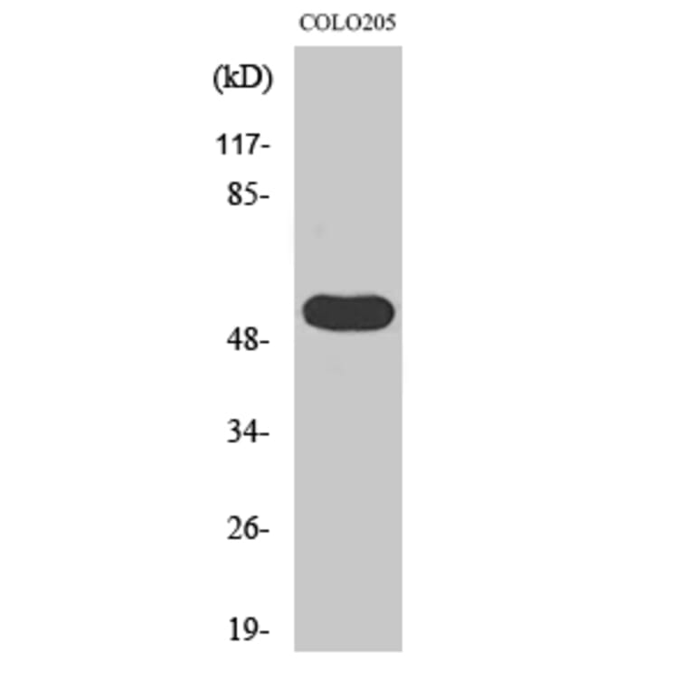 Western Blot - Anti-LIPI Antibody (C16481) - Antibodies.com