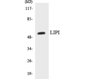 Western Blot - Anti-LIPI Antibody (R12-2971) - Antibodies.com