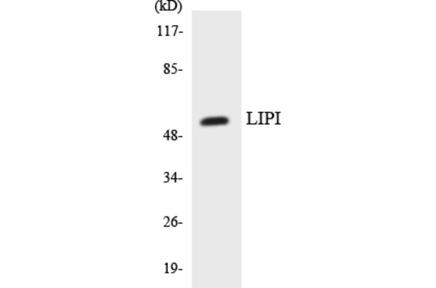 Western Blot - Anti-LIPI Antibody (R12-2971) - Antibodies.com