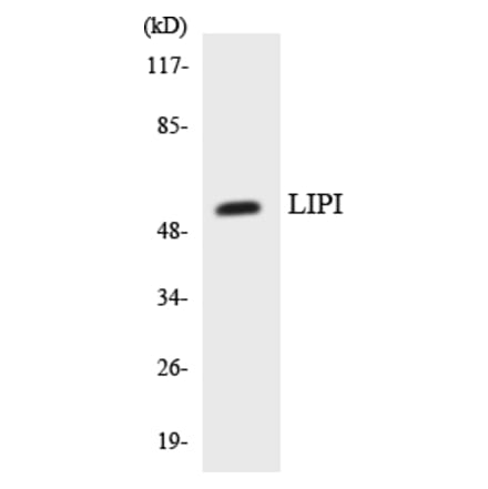Western Blot - Anti-LIPI Antibody (R12-2971) - Antibodies.com