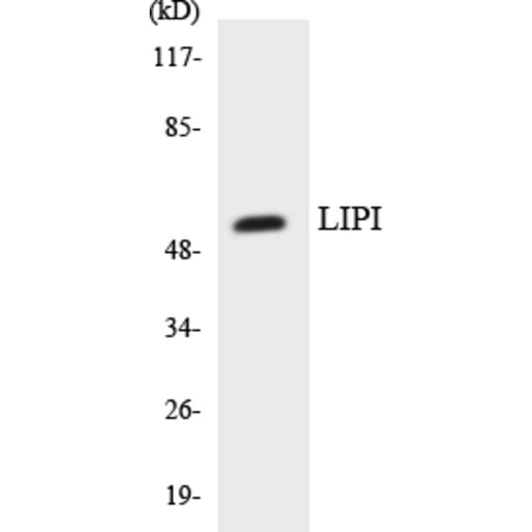 Western Blot - Anti-LIPI Antibody (R12-2971) - Antibodies.com