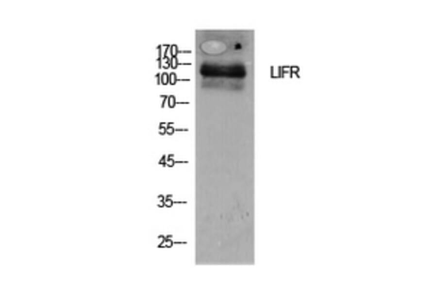 Western Blot - Anti-LIFR Antibody (C30420) - Antibodies.com