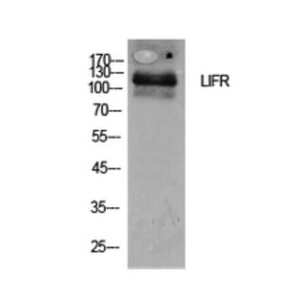 Western Blot - Anti-LIFR Antibody (C30420) - Antibodies.com