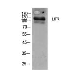 Western Blot - Anti-LIFR Antibody (C30420) - Antibodies.com