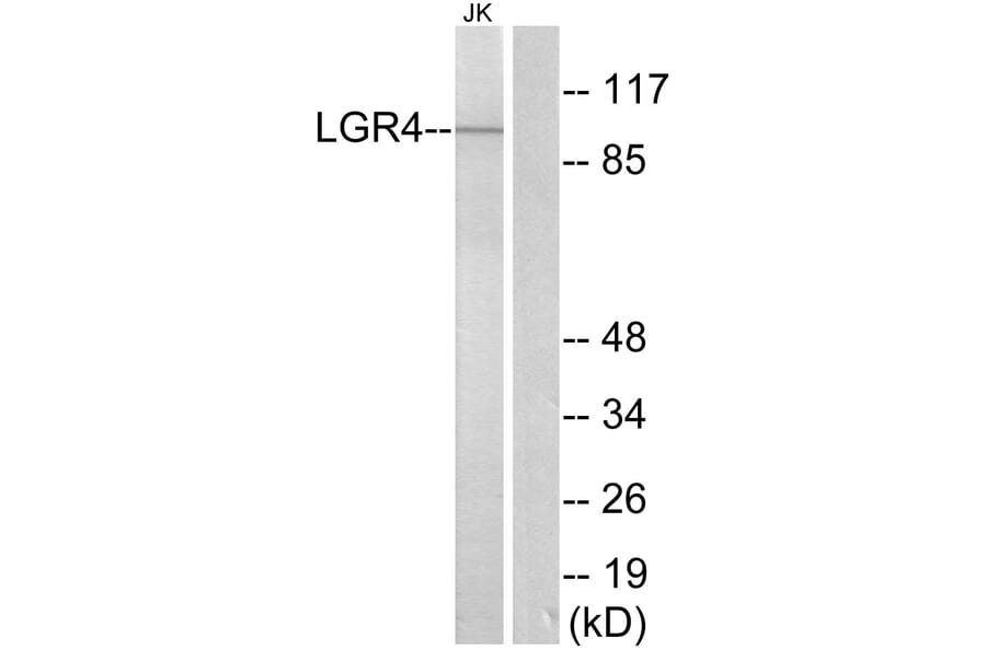 Western Blot - Anti-LGR4 Antibody (G374) - Antibodies.com