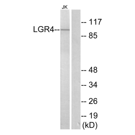 Western Blot - Anti-LGR4 Antibody (G374) - Antibodies.com