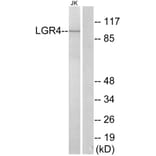 Western Blot - Anti-LGR4 Antibody (G374) - Antibodies.com
