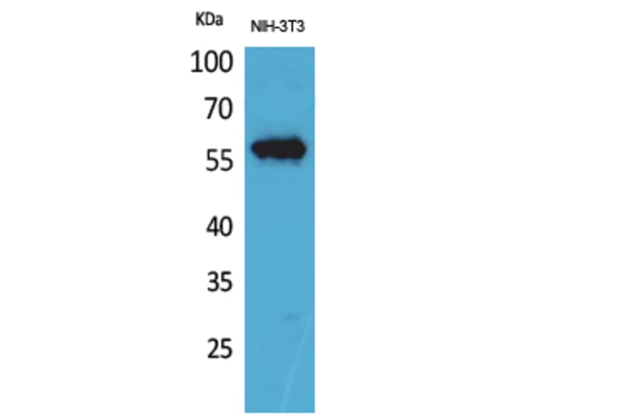 Western Blot - Anti-LAG3 Antibody (C30549) - Antibodies.com