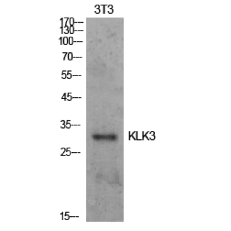 Western Blot - Anti-KLK3 Antibody (C30074) - Antibodies.com