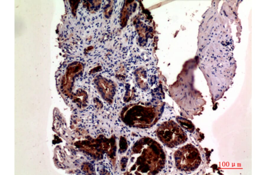 Immunohistochemistry - Anti-KLK3 Antibody (C30074) - Antibodies.com