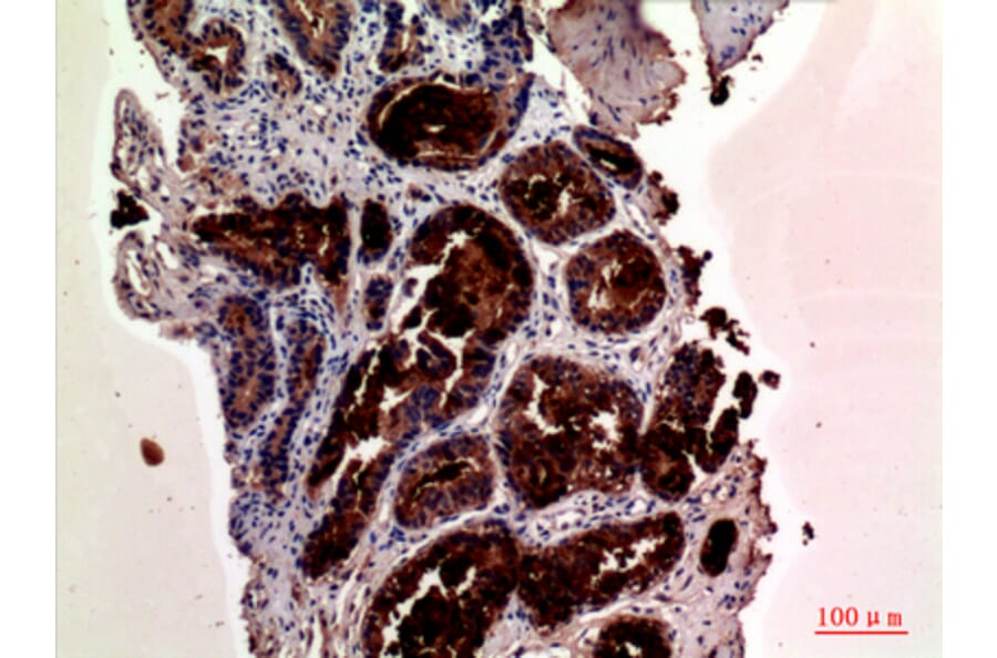Immunohistochemistry - Anti-KLK3 Antibody (C30074) - Antibodies.com
