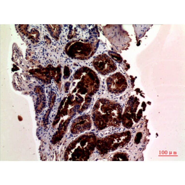 Immunohistochemistry - Anti-KLK3 Antibody (C30074) - Antibodies.com