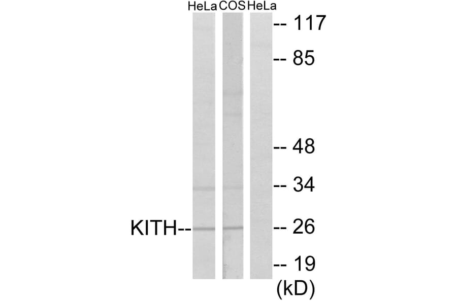 Western Blot - Anti-KITH Antibody (C10270) - Antibodies.com