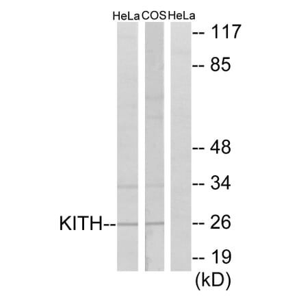 Western Blot - Anti-KITH Antibody (C10270) - Antibodies.com