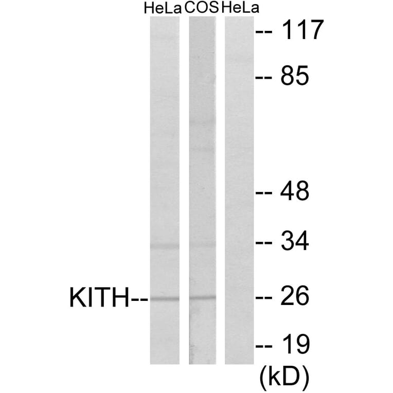 Western Blot - Anti-KITH Antibody (C10270) - Antibodies.com