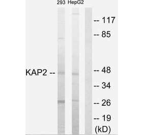 Western Blot - Anti-KAP2 Antibody (C10363) - Antibodies.com
